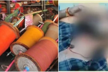 மாஞ்சா நூல் அறுத்ததில் கழுத்தில் 16 தையல்கள் - தீவிர சிகிச்சை பிரிவில் இளைஞர்!