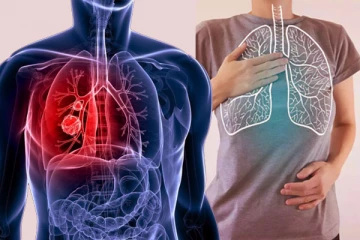 இளைஞர்களை தாக்கும் நுரையீரல் புற்று நோய் என்ன காரணம் தெரியுமா?