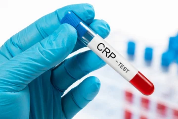 கோவிட் தொற்று பரிசோதனைகளை முன்னெடுக்க வேண்டாம்: சுகாதார அமைச்சு உத்தரவு!