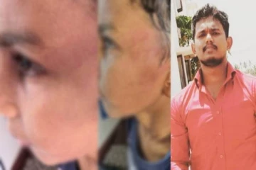 ஷூ போடல.. மாணவனை கண்மூடித்தனமாக தாக்கிய பள்ளி நிர்வாகி - பார்வை பறிபோகும் அபாயம்!