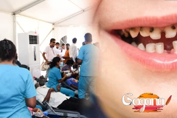 දරුවන්ගේ කිරි දත්වලට වෙච්ච දෙයක්... පරිස්සම් කර ගන්න