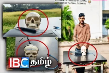 யாழ். பல்கலைக்கழக கல்லூரி மாணவன் சாதனை - மூளைக் கட்டியை கண்டறிய புதிய இயந்திரம்