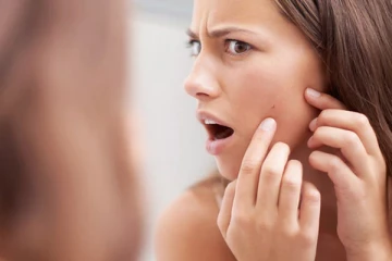 முகப்பரு மற்றும் கரும்புள்ளி பிரச்சனையா? இதை எப்படி எளியமுறையில் போக்கலாம்?