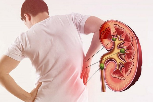 சிறுநீரகத்தில் கல்லடைப்பு பிரச்சனையா? நிரந்தர தீர்வு அளிக்கும் வாழைத்தண்டு | Banana Stem Food Your Diet Healthy Benefits