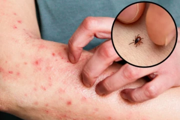 தமிழகத்தில் வேகமாக பரவும் Scrub Typhus தொற்று- பொது சுகாதாரத்துறை எச்சரிக்கை