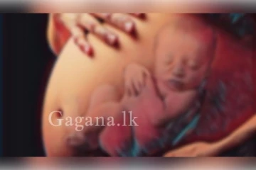 නොසැලකිලිමත්ව දරු ගැබක් විනාශ කර මවගේ ජිවිතයද නැසූ වෛද්‍යවරයාට අධිකරණයෙන් නියෝගයක්..