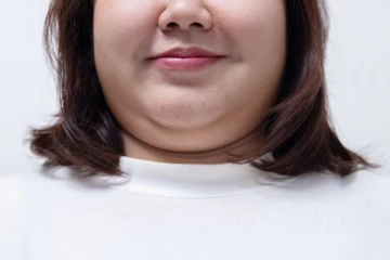 முகத்தை குண்டாக காட்டும் முகக் கொழுப்பு - வீட்டில் இருந்தப்படியே குறைப்பது எப்படி?