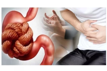 மலச்சிக்கலால் அவதியா? இதோ பாட்டி வைத்தியம்