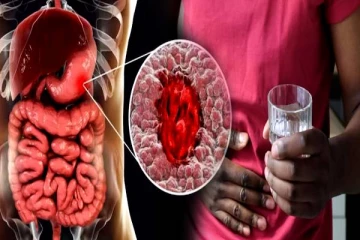 அல்சரிலிருந்து தப்பிக்க சாப்பிட வேண்டியவை - தவிர்க்க வேண்டியவை.. தெரிஞ்சிக்கோங்க!