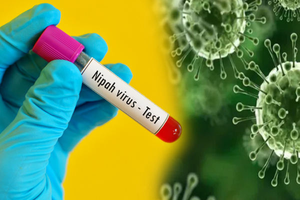இலங்கையில் நிபா வைரஸ் தொற்று அச்சுறுத்தல் இல்லை | There Is No Threat Of Nipah Virus Infection Lanka இலங்கையில் நிபா வைரஸ் தொற்று அச்சுறுத்தல் இல்லை | There Is No Threat Of Nipah Virus Infection Lanka