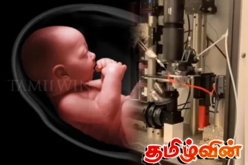 அரச மருத்துவமனையொன்றில் செயற்கை கருத்தரித்தல் மூலம் பிறந்த முதலாவது குழந்தை