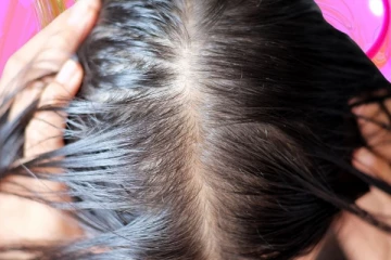 போதும் போதும்னு சொல்ற அளவுக்கு முடி வளரணுமா? இந்த ஒரே ஒரு பொருள் போதும்.... அதிசயம் நடக்கும்!