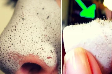 மூக்கின் மீது உள்ள கரும்புள்ளிகளை விரட்டியடிக்கும் ஒரு ஒரு இயற்கை பொருள்! பக்க விளைவு அறவே இல்லை