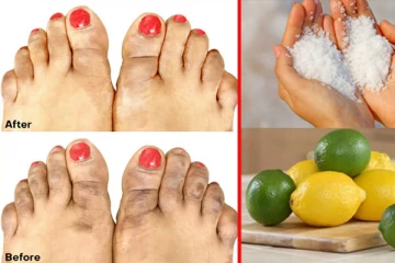 சுட்டெரிக்கும் வெயிலால் கருமையான கால்களை சிவப்பாக மாற்றுவது எப்படி?