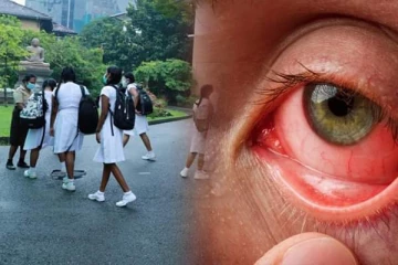 பாடசாலை மாணவர்களிடையே வேகமாக பரவும் கண் நோய்