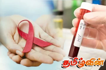 அநுராதபுரத்தில் எய்ட்ஸ் நோயாளிகளின் எண்ணிக்கையில் ஏற்பட்ட மாற்றம்