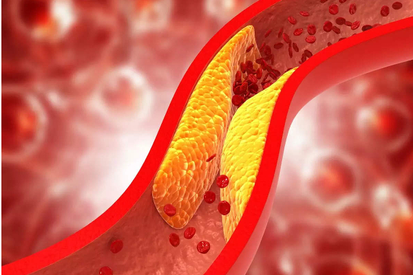 மாம்பழம் சாப்பிடும் போது செய்யக்கூடாத தவறுகள்! பயங்கர பக்கவிளைவு ஏற்படுமாம் | Mango Benefits In Tamil