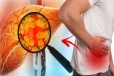 இந்த 5 அறிகுறிகள் இருக்கா? அப்போ உங்கள் கல்லீரல் பத்திரம்