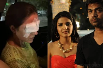 சிம்பு பட நடிகைக்கு கண்பார்வை போச்சு.. கான்டாக்ட் லென்ஸ் போட்டவருக்கு நடந்த அதிர்ச்சி