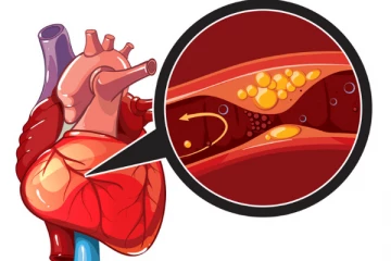 இரத்த குழாயில் அடைப்பு உள்ளதை வெளிக்காட்டும் அறிகுறிகள்...அலட்சியம் வேண்டாம்! உயிரே போய் விடும்