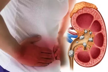 சிறுநீரக கல் பிரச்சினையா? உடனடியாக கரைக்கும் பூ