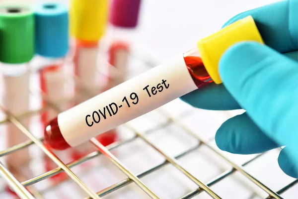 யாழ் மக்களுக்கு எச்சரிக்கை; மீண்டும் வந்த கொரோனா! | Corona Infection In A Woman In Yali