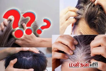 இளம் வயதிலேயே வெள்ளை முடி வருவது ஏன்?