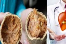 யாருக்கெல்லாம் விளாம்பழம் பிடிக்காது? இவ்வளவு மருத்துவ குணங்கள் இருக்கா? இத படிங்க... இனி தினமும் சாப்பிடுவீங்க!