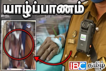 தமிழர் பிரதேசத்தை உலுக்கும் வாள்வெட்டு : யாழில் துண்டாக்கப்பட்ட வியாபாரியின் விரல்கள்