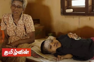 உதவ யாருமில்லை இறந்து விடலாம் அம்மா! கண்ணீருடன் கதறும் 43 வயது குழந்தை