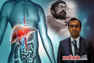 நடிகர் அபினய்க்கு வந்த கல்லீரல் நோய் - விளக்கிய மருத்துவர்