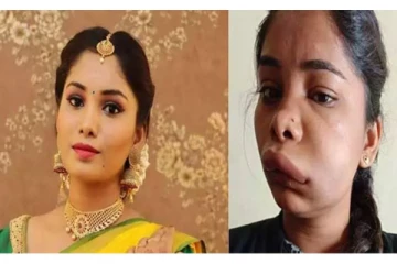 பல் வலிக்கு சிகிச்சை.. நடந்த சோகம் - பதறிய நடிகை!