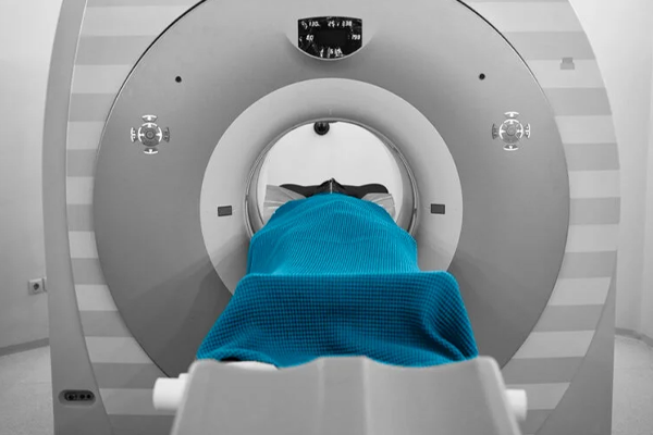 Pet scan