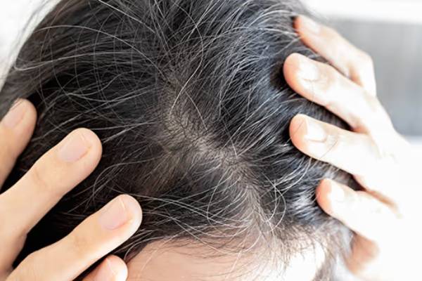 இளைஞர்களிடையே அதிகரிக்கும் இளநரை.., காரணம் என்ன தெரியுமா? | These Are The Reason Behind Your Grey In Tamil