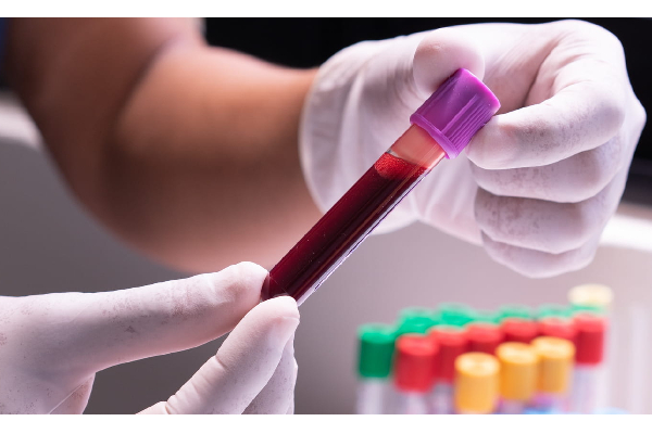 Blood sample