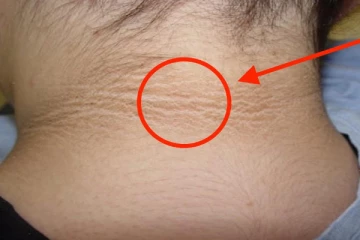 விடாப்பிடியாக கழுத்தில் இருக்கும் கருமையை போக்கனுமா? இந்த ஒரு பொருளை இப்படி போடுங்க...!