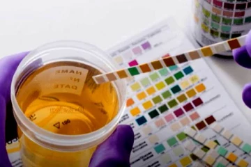 சிறுநீர் பழுப்பு நிறத்தில் வெளியேறுகிறதா? அப்போ கண்டிப்பாக இந்த நோய் இருக்கும்!