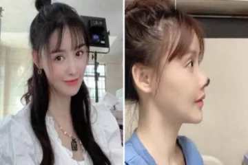 ஏற்கனவே பேரழகு! மேலும் வசீகரமாக மாற இளம்பெண் செய்த செயல்.. நேர்ந்த விபரீதத்தால் சூன்யமாகி போன எதிர்காலம்