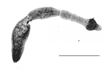 கனடாவில் அதிகரித்துவரும் புற்றுநோய் போன்ற அபூர்வ வகை உயிர்க்கொல்லி நோய்