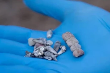 குழந்தைகளின் பல்லை பிடுங்கி கொடூர கொலை - ஹமாஸ் குறித்த திடுக்கிடும் தகவல்!