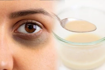 கருவளையத்தை நிரந்தரமாக நீக்க உதவும் பால்.., எப்படி பயன்படுத்துவது?