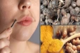 தேவையற்ற முடிகளை நிரந்தரமாக நீக்கும் Face pack- எத்தணை தடவை போடலாம்?