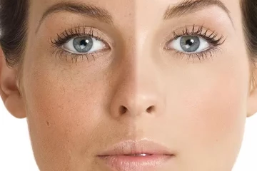 இரண்டே நாட்களில் முகத்தில் உள்ள கருமை நீங்க வேண்டுமா? இதோ சில எளிய வழிகள்