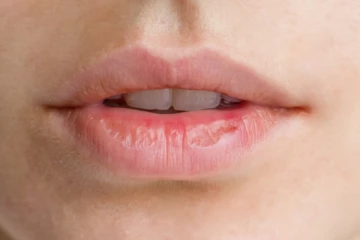 உதடு அதிகமாக வறண்டு போகிறதா? இந்த வீட்டு வைத்தியங்களை முயற்சிக்கவும்