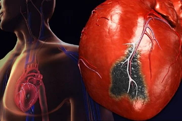 இதய நோயாளிகள் அதிகமாக ஊறுகாய் சாப்பிட்டால் ஆபத்து! என்னென்ன பிரச்சனைகள் ஏற்படும் தெரியுமா?