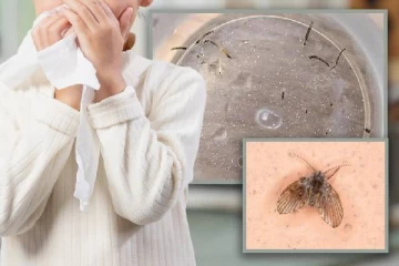 ஒரு மாதமாக உயிருடன் புழுவை வாந்தி எடுத்த சிறுமி - பரிசோதனையில் மருத்துவர்கள் ஷாக்!