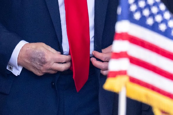 நான் தினமும் 325 mg ஆஸ்பிரின் எடுத்துக் கொள்கிறேன்! உடல்நிலை குறித்து டிரம்ப் பேட்டி | Donald Trump Says I M Perfectly Healthy