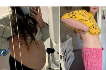 9 மாத கர்ப்பிணியாக கருதப்பட்ட இளம் பெண் வயிற்றிலிருந்து 13 அங்குல நீர்க்கட்டி அகற்றப்பட்டது!