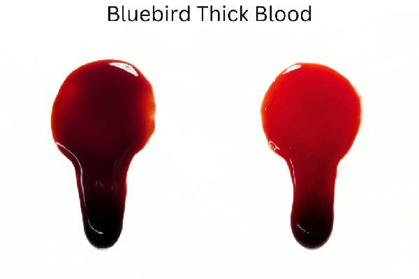 உடலில் இரத்தம் கெட்டியாகினால் முதலில் காட்டும் அறிகுறிகள் எவை? | Thick Blood Side Effects Warning Signs