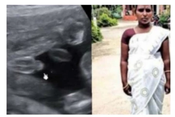 வயிற்றில் குழந்தை என நினைத்து சிகிச்சை - பின்னர் ஸ்கேனில் தெரிந்த உண்மை - அதிர்ந்து போன மருத்துவர்கள்!